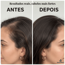 Escova Massageadora com Laser 4 em 1 - | Souza Plena